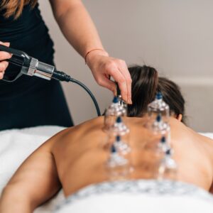 Cupping