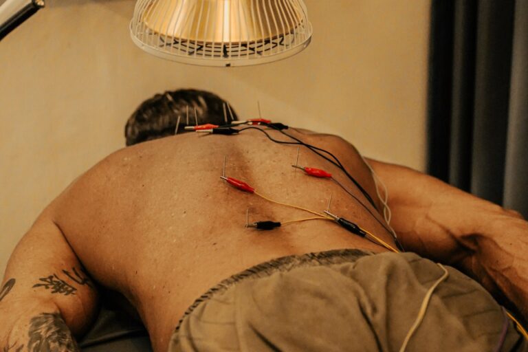 acupuncture-bali-services-acupunture-1